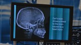 Post-Mortem Live - screen